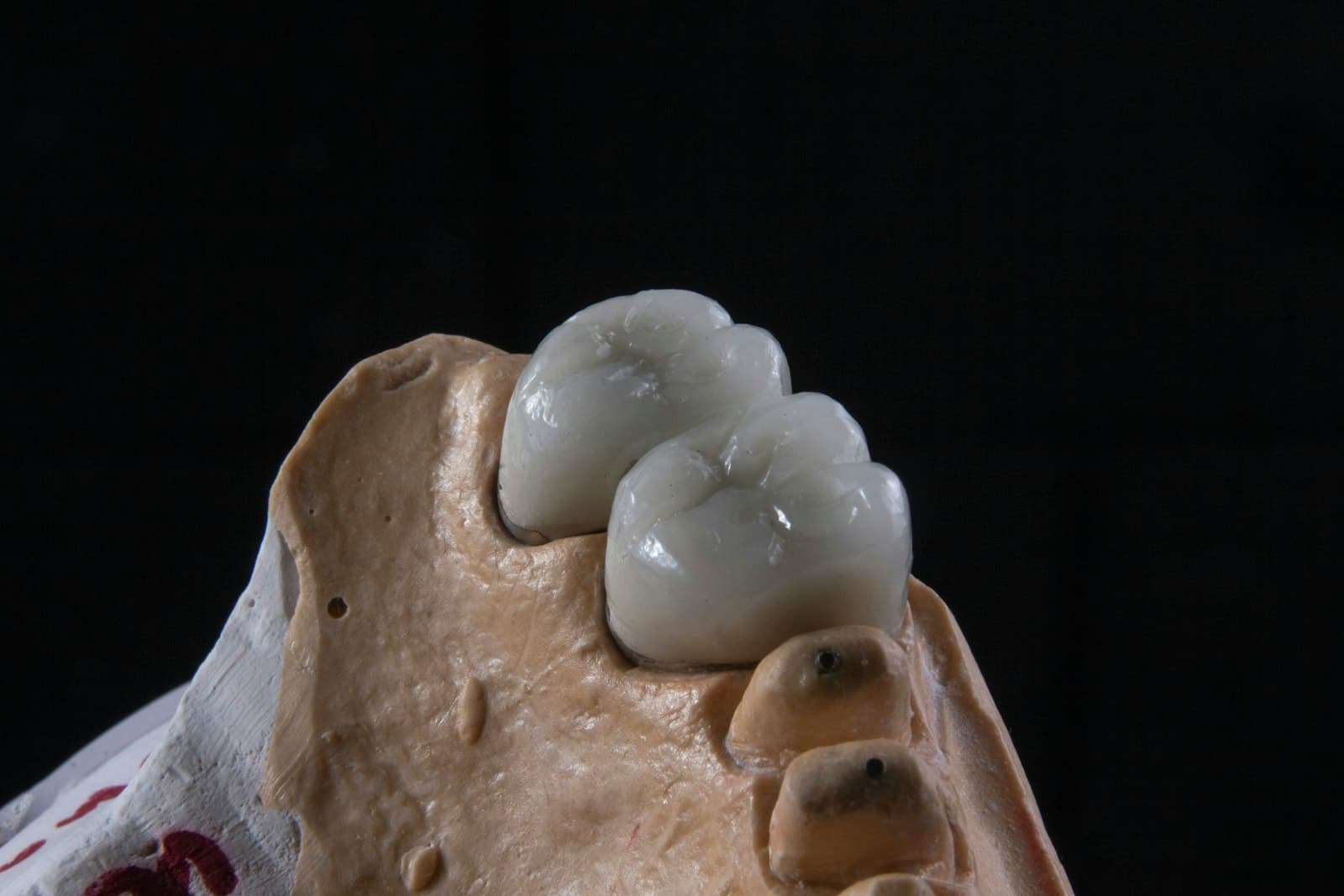 A crown being shade-matched under a daylight-simulating light