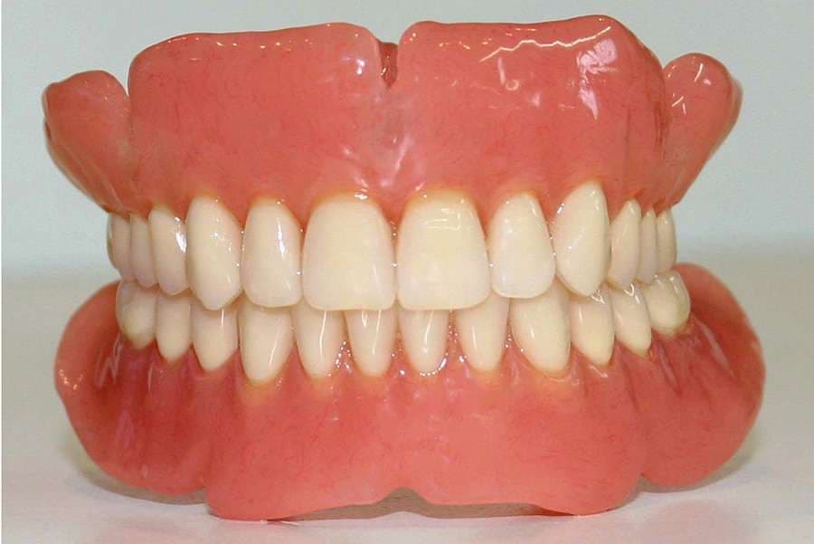 Acrylic Dentures at the Wessex dental laboratory